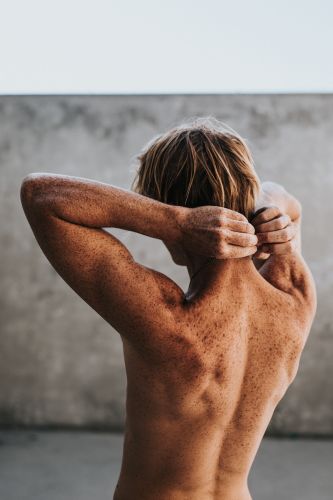 Young man with an exposed back covered in freckles